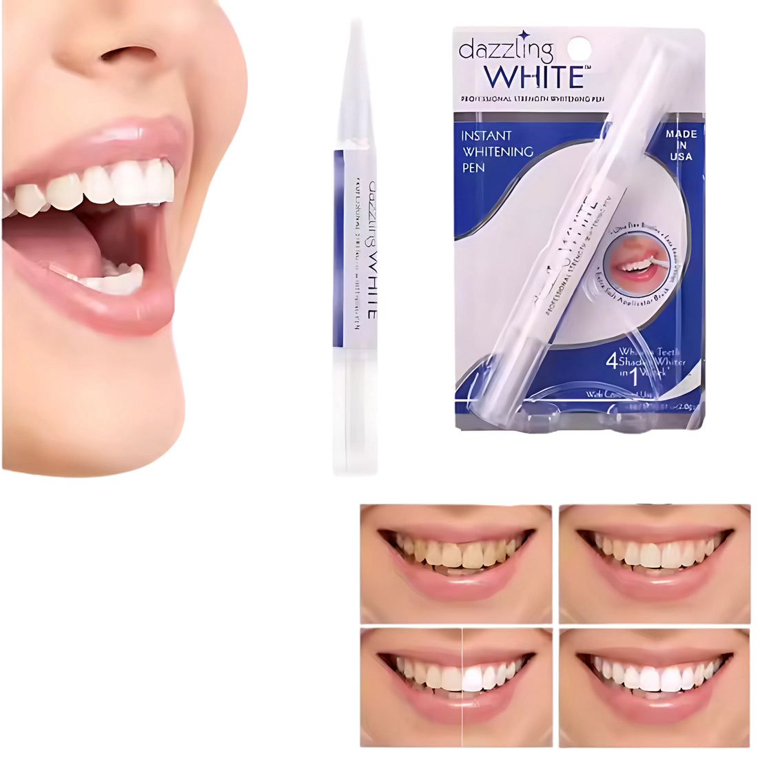 GEL BLANQUEADOR DE DIENTES